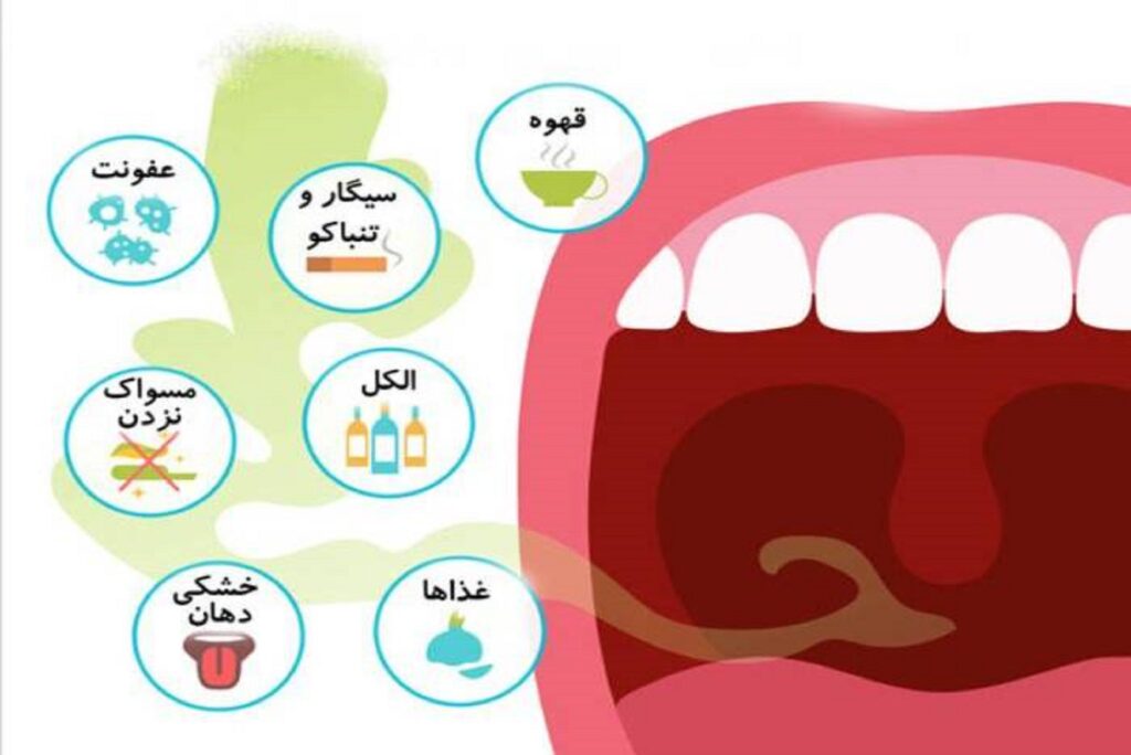 علل بوی بد دهان