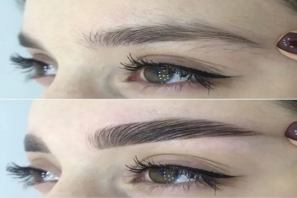 Micro-pigmentation